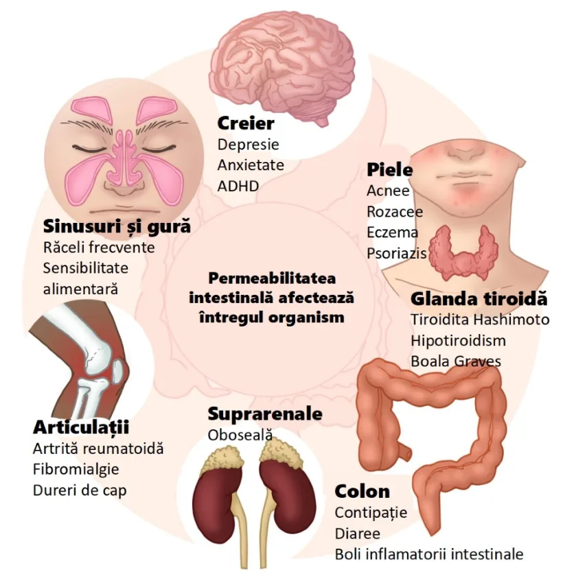 Dieta ”occidentală” duce la creșterea cazurilor de boli autoimmune în rândul populației