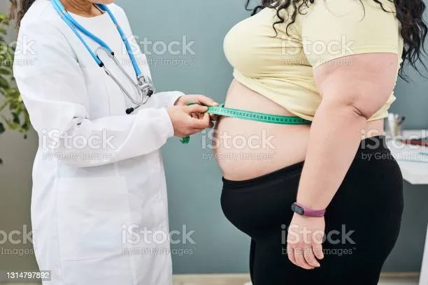 Obezitatea, un flagel şi un stigmat mondial