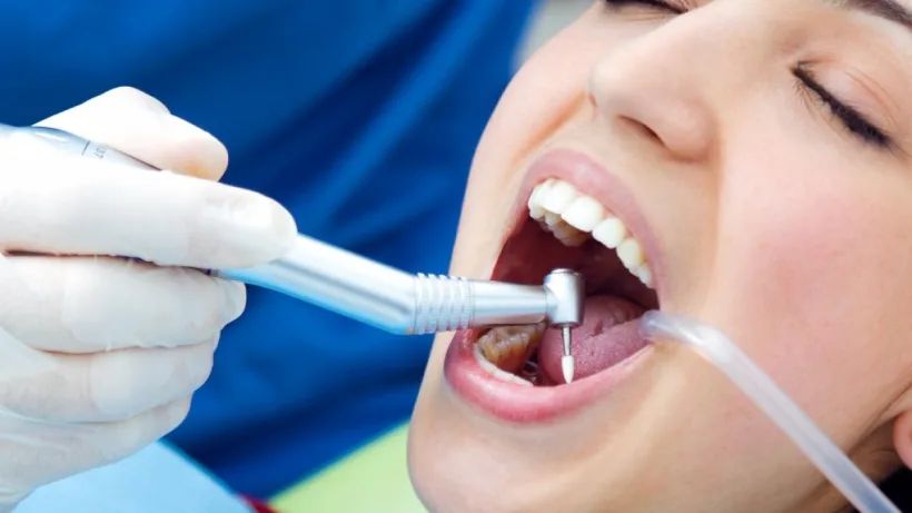 Mai mult de jumătate dintre români prezintă semne de afecțiuni gingivale