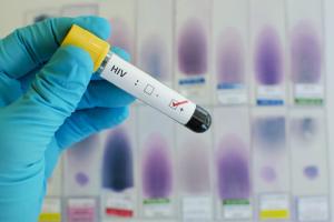 De la 1 iulie este decontată testarea pentru HIV-SIDA a gravidelor neasigurate