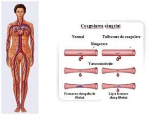 Vaccinul  AstraZeneca, nou efect secundar asupra persoanelor cu afecțiuni sangvinice