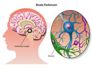 Nouă descoperire pentru tratarea bolii Parkinson