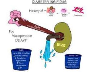 Ați auzit de diabetul insipid?