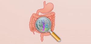 Abuzul de antibiotice, E-urile și stresul, riscuri de îmbolnăvire intestinală