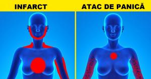 Diferenţa dintre un atac de panică şi infarct